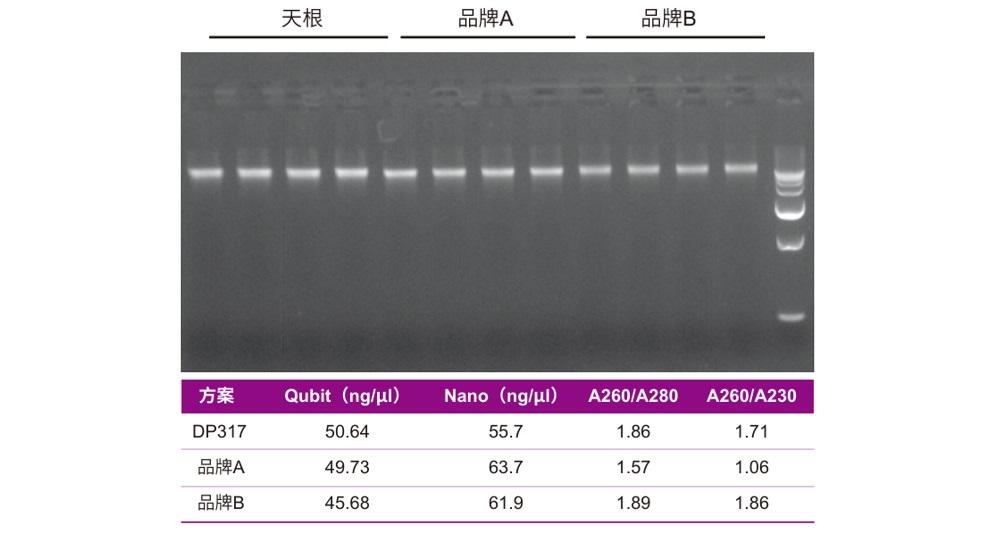 使用DP317、品牌A和品牌B提取白色念珠菌（OD600 =2.0 ，2 ml菌液）基因组DNA，琼脂糖凝胶电泳及紫外分光光度计测值结果表明DP317的提取效果均优于品牌A 和品牌B
